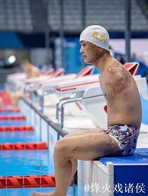 全国残特奥会｜“无臂飞鱼”袁伟译：勇敢迈向“第二道坎”